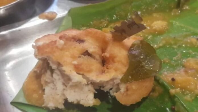 UZHUNU VADA