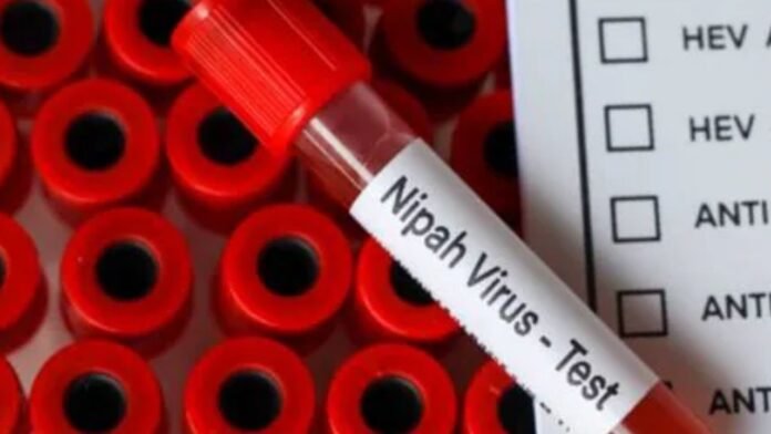 Nipah virus test