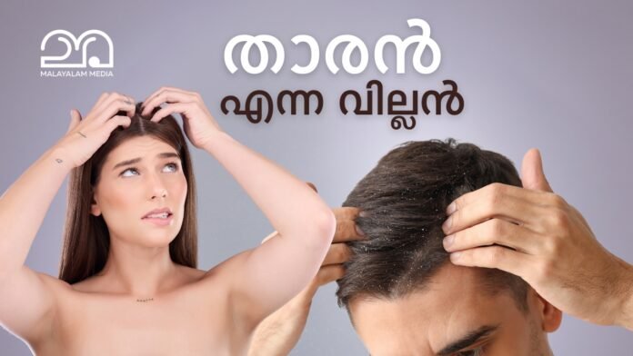 dandruff skin disease causes treatment