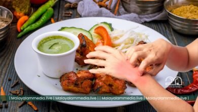 Food Allergy