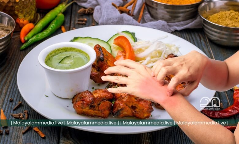 Food Allergy