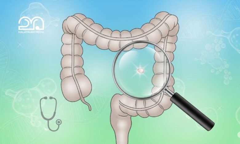 Colon cancer symptoms